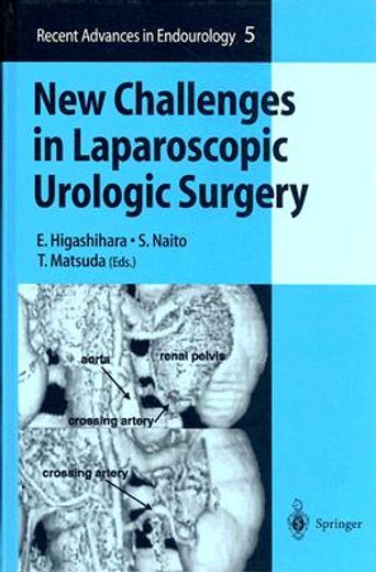 new challenges in laparoscopic urologic surgery (in English)