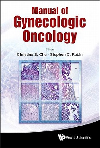 manual of gynecologic oncology