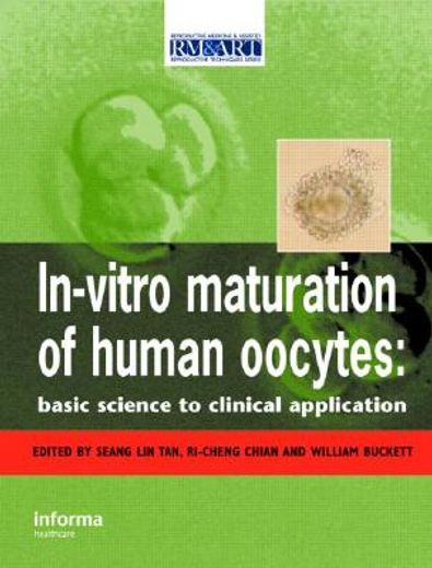 In Vitro Maturation of Human Oocytes (en Inglés)