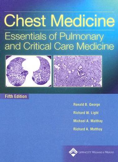 chest medicine,essentials of pulmonary and critical care medicine