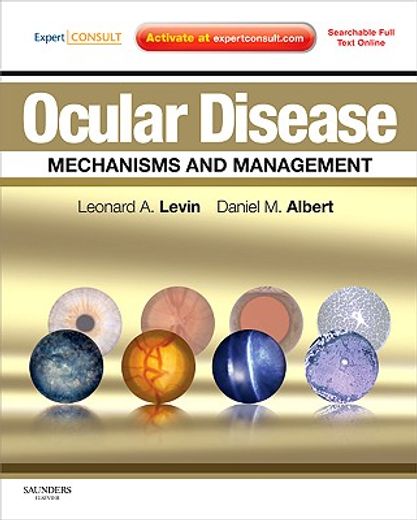 ocular disease,mechanisms and management: expert consult