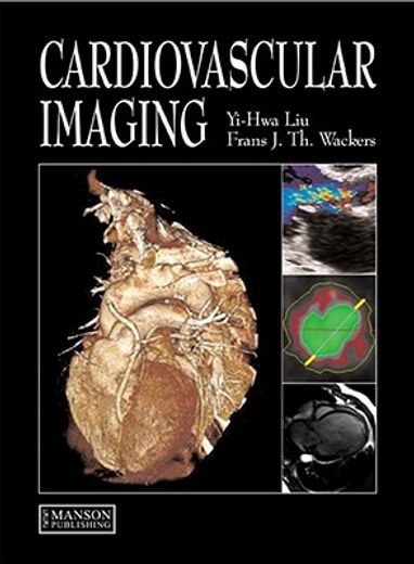 cardiovascular imaging