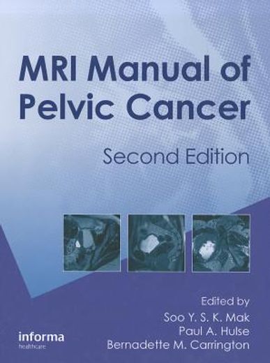MRI Manual of Pelvic Cancer, Second Edition (en Inglés)
