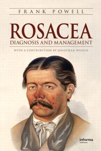 Rosacea: Diagnosis and Management (en Inglés)