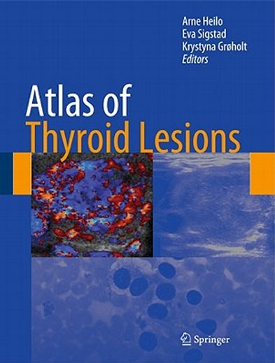 Atlas of Thyroid Lesions (en Inglés)