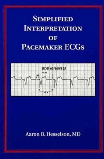 Simplified Interpretation of Pacemaker Ecgs (en Inglés)