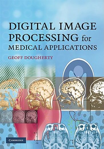 digital image processing for medical applications (en Inglés)