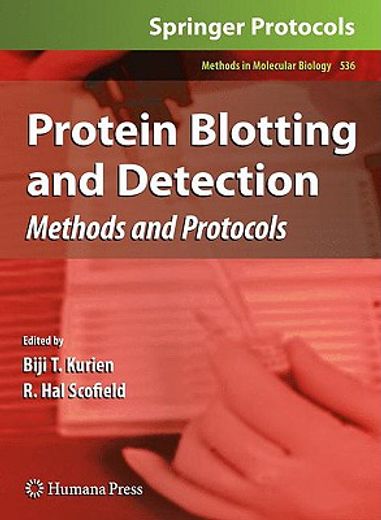 Protein Blotting and Detection: Methods and Protocols (en Inglés)