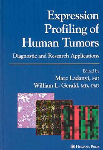 expression profiling of human tumors