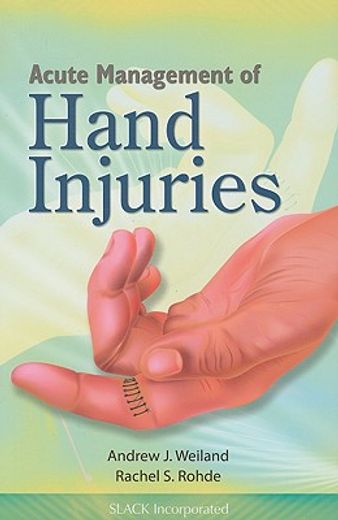 acute management of hand injuries