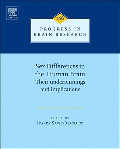sex differences in the human brain