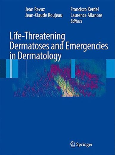 life-threatening dermatoses and emergencies in dermatology