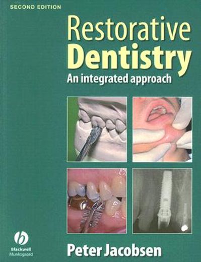 Restorative Dentistry 2e (en Inglés)