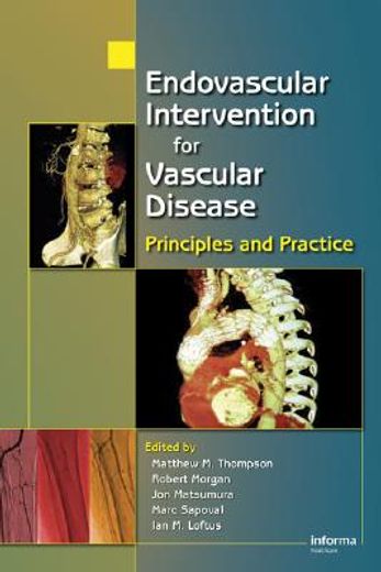 endovascular intervention for vascular disease,principles and practice