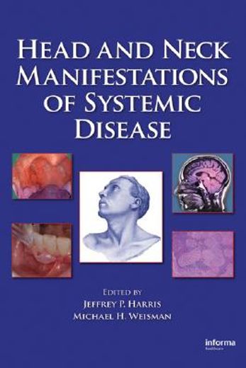 head and neck manifestations of systemic disease