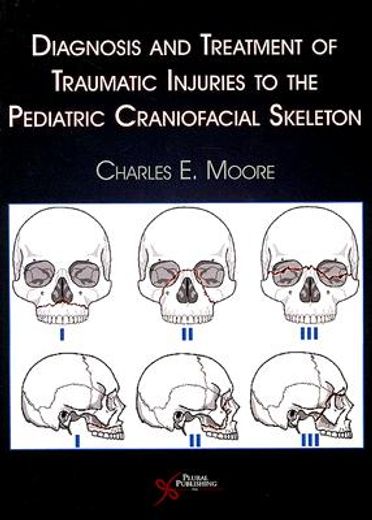 diagnosis and treatment of traumatic injuries to the pediatric craniofacial skeleton