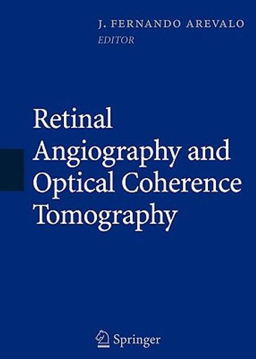retinal angiography and optical coherence tomography