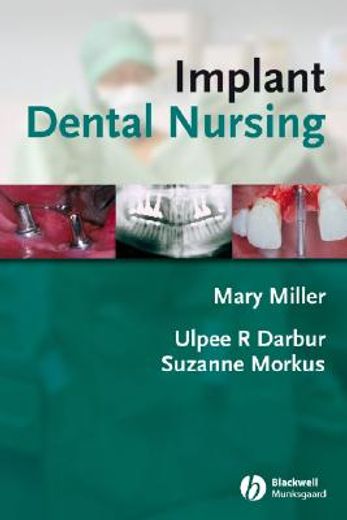 Implant Dental Nursing (in English)