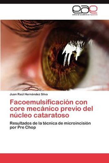 facoemulsificaci n con core mec nico previo del n cleo cataratoso (in Spanish)
