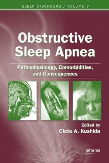 obstructive sleep apnea,pathophysiology, comorbidities, and consequences