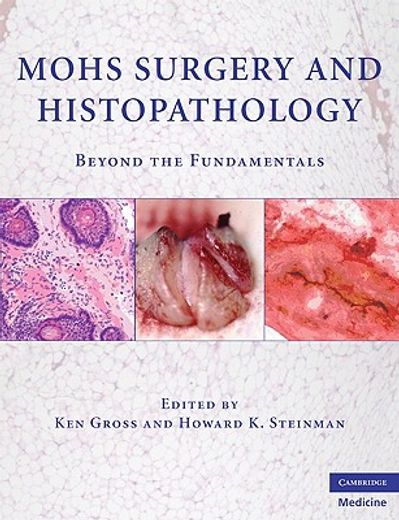 mohs surgery and histopathology,beyond the fundamentals (en Inglés)