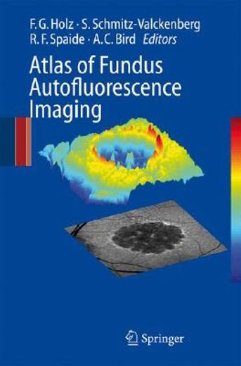 atlas of fundus autofluorescence imaging (en Inglés)