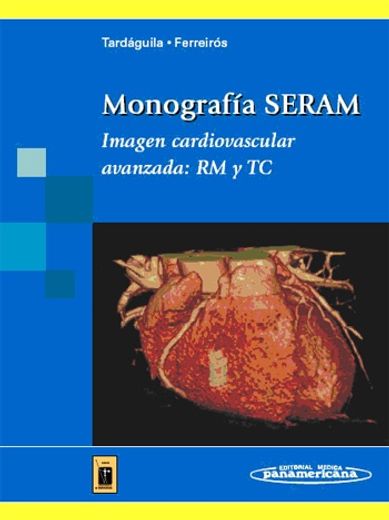 Monografía SERAM: Imagen cardiovascular avanzada: RM y TC (Tardáguila / Ferreirós)