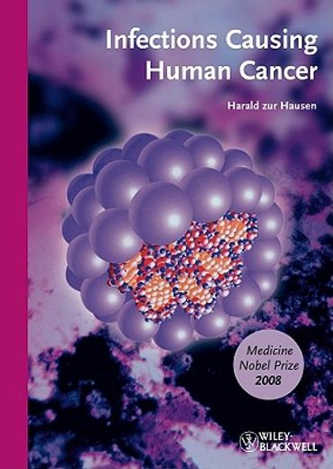 Infections Causing Human Cancer: Softcover Edition (en Inglés)