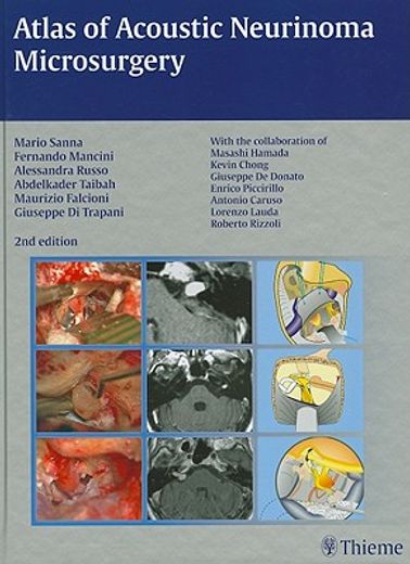 Atlas of Acoustic Neurinoma Microsurgery (en Inglés)
