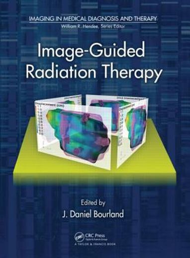 Image-Guided Radiation Therapy (en Inglés)