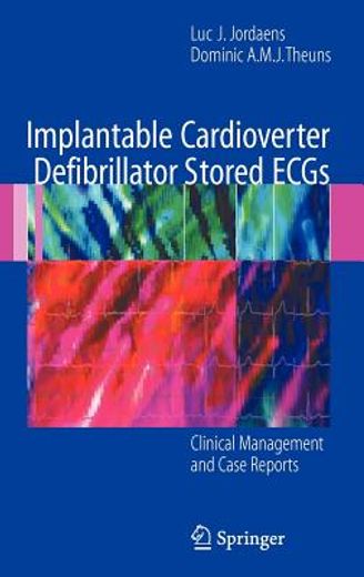 implantable cardioverter defibrillator stored ecgs,clinical management and case reports