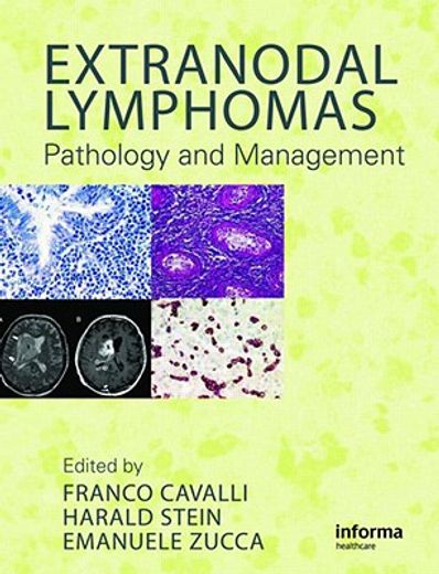 extranodal lymphomas,pathology and management