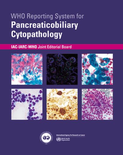 Who Reporting System for Pancreaticobiliary Cytopathology (in English)