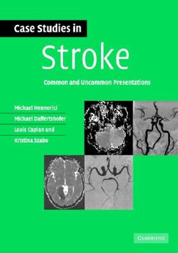 case studies in stroke,common and uncommon presentations (en Inglés)