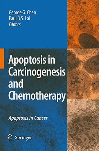 apoptosis in carcinogenesis and chemotherapy,apoptosis in cancer