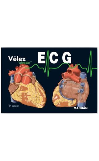 Ecg: Pautas de Electrocardiografía (in Spanish)