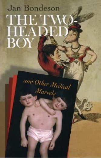 the two-headed boy, and other medical marvels (en Inglés)