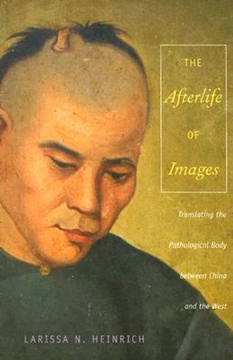 afterlife of images,translating the pathological body between china and the west