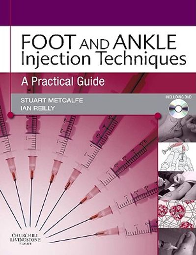 foot and ankle injection techniques,a practical guide
