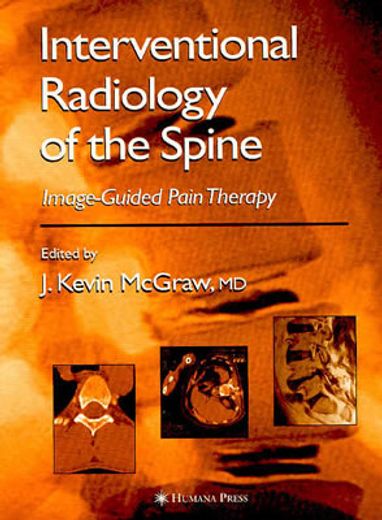 Interventional Radiology of the Spine: Image-Guided Pain Therapy (en Inglés)