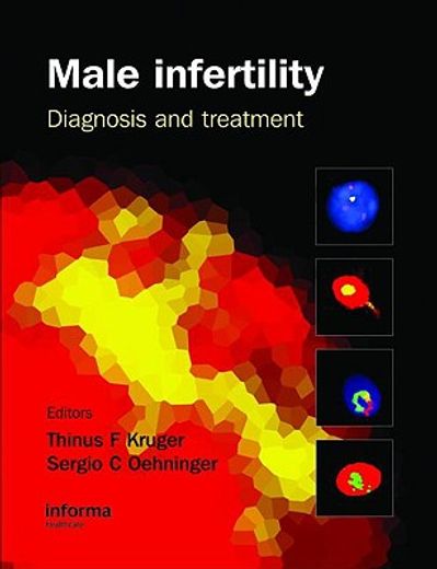 male infertility,diagnosis and treatment