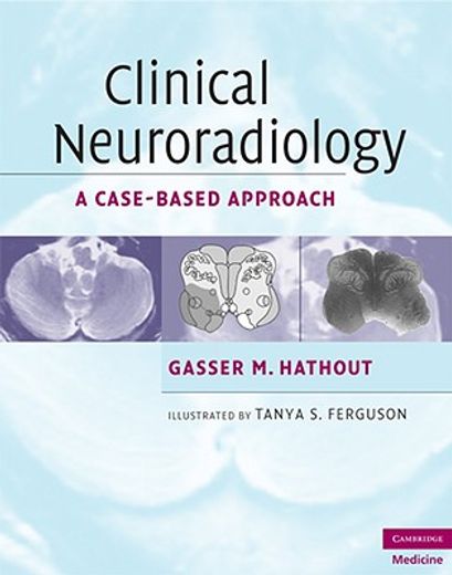 clinical neuroradiology,a case based approach