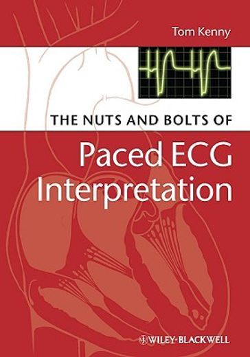 nuts and bolts of paced ecg interpretation (en Inglés)