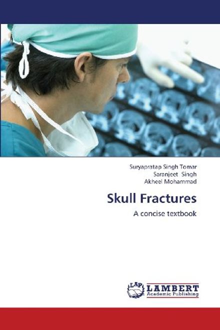 Skull Fractures portada Skull Fractures